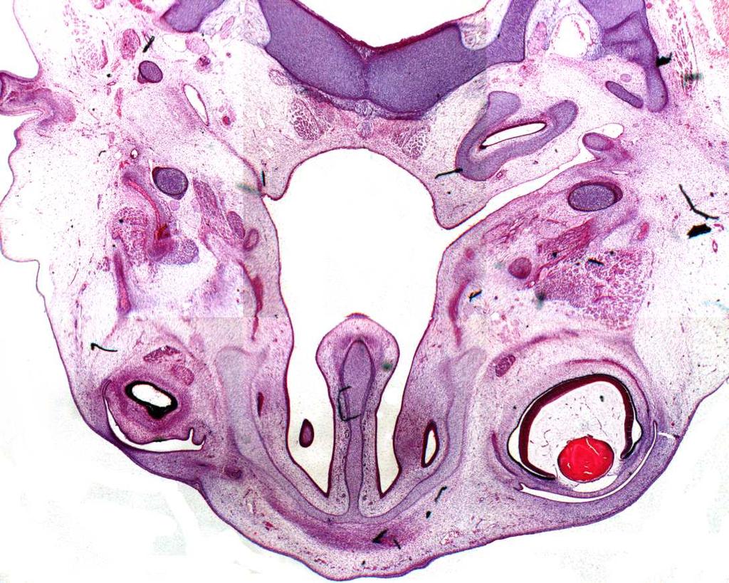 4.5.3 Processus styloideus und Ligamentum stylohyoideum Auch bei diesem Embryo liegt die Anlage des Processus styloideus in Form zweier separater Knorpelanteile vor, einem kegelförmigen cranialen