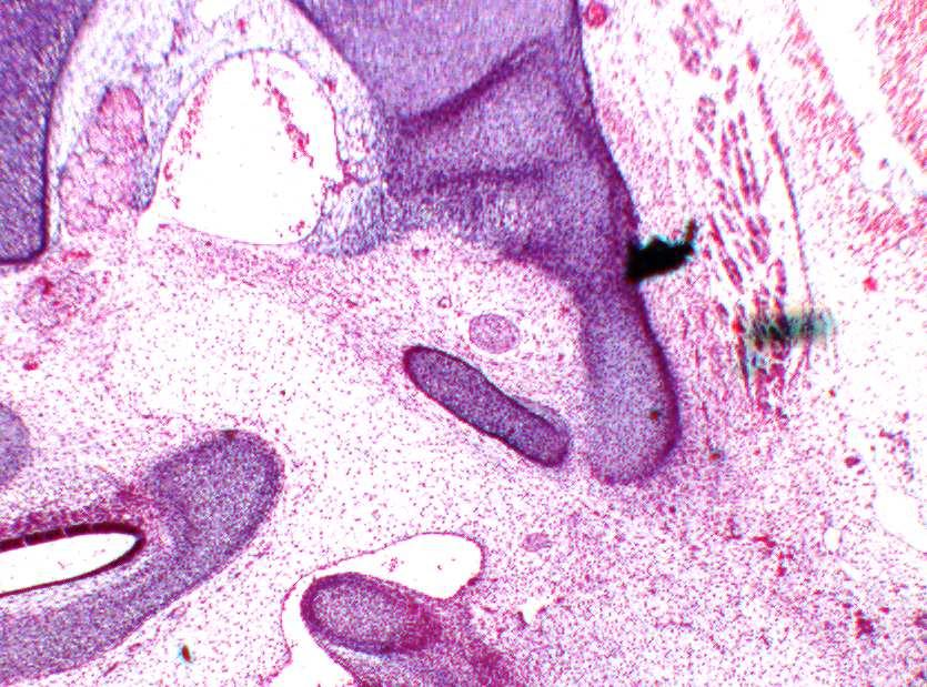 Ein Knorpel als Vorstufe des Ligamentum stylohyoideum ist nicht sichtbar (Abb. 36 und 37). Os occipitale Processus styloideus Malleus* M. pterygoideus lateralis M.