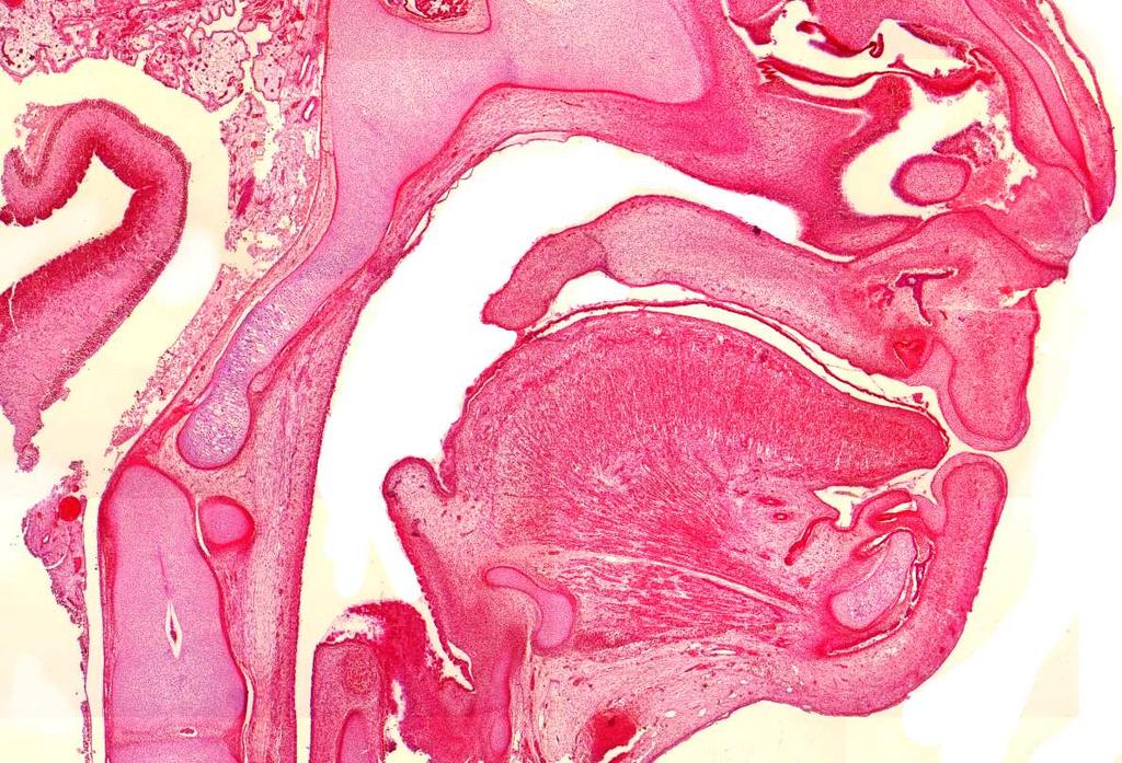 Woche (HAN 040389) 3D-Rekonstruktion, Darstellung der suprahyalen Muskulatur Ansicht von lateral, 30 caudal Os occipitale Os nasale Cerebrum Oropharynx