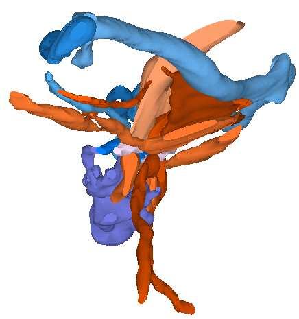 4.2.1 Os hyoideum Die folgenden Abbildungen stellen die Lagebeziehung des Os hyoideum zum Meckel schen Knorpel sowie zur infra- und suprahyalen Muskulatur dar (Abb. 11 und 12). Abb. 11 zeigt von cranial nach caudal den Meckel schen Knorpel, dorsal davon Incus und Stapes, den das Os hyoideum und den Larynx.