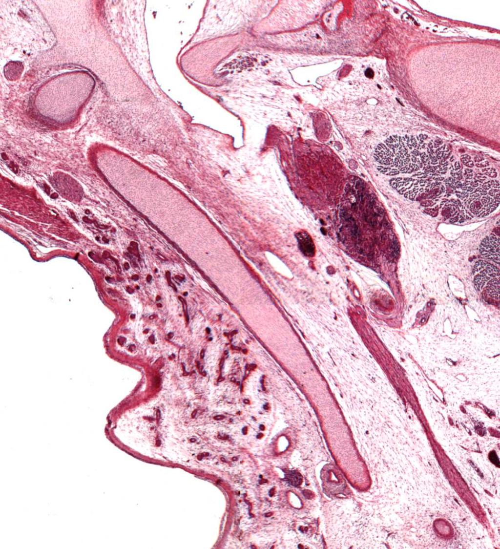 Inferius nervi vagi Processus styloideus N. glossopharyngeus 500 µm Epihyaler Knorpel (Ligamentum stylohyoideum) Abb.