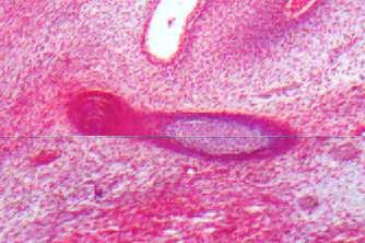 styloideus, b Costa 2 Clavicula Costa 1 Abb. 16 Embryo 19 mm CRL, 7.