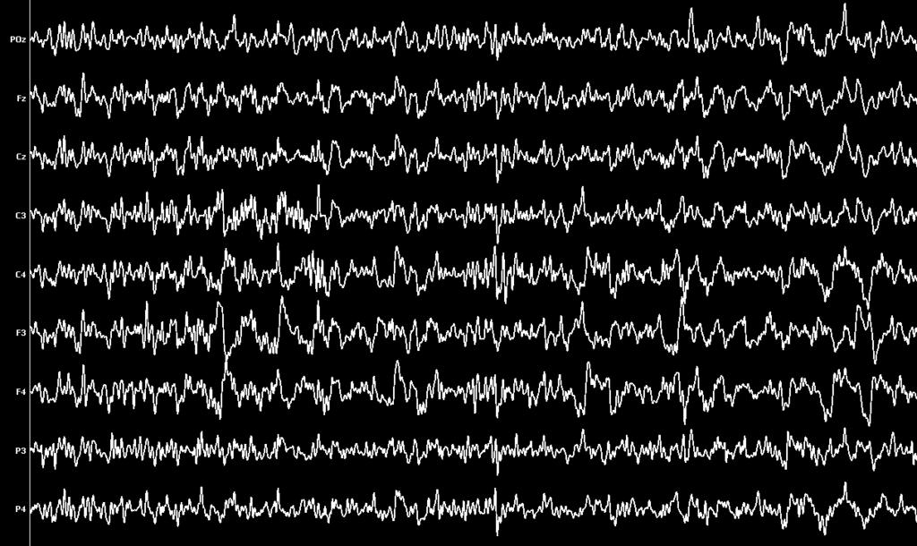 EEG : https://cdn.imotions.