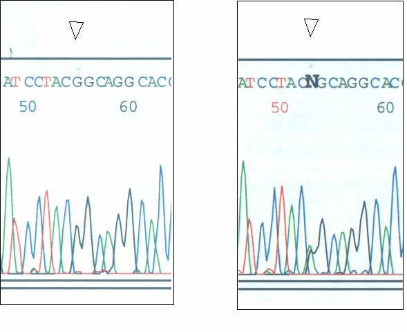 Abbildung 18: Ausschnitt aus der DNA-Sequenzen des Exons 12 des MYBP C Gens des G-Allels (Wild-Typ) links und des GA-Allels.