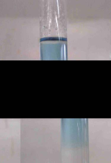 Methylenblau gut sichtbar (rechts).
