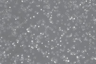 Phasenkontrast U2OS Zellen, GFP