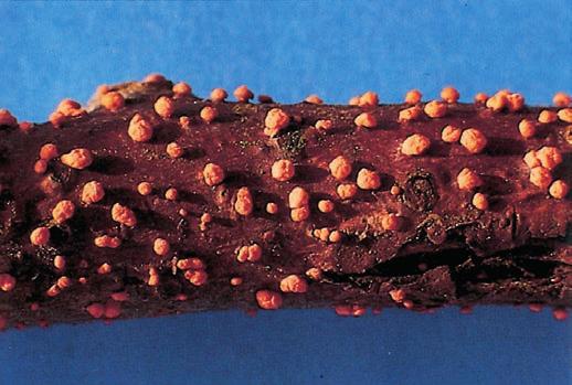 Rotpustelkrankheit (Nectria cinnabarina) Bedeutung: Der Pilz befällt bevorzugt geschwächtes Beerenobst, vor allem Johannisbeeren und Stachelbeeren.