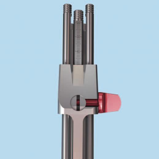3b Osteotomie-Zielgerät einstellen (Anwendung mit Messeinstellung) Instrument 03.108.
