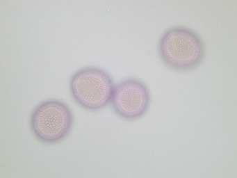 Das am Lichtmikroskop aufgenommene Foto (siehe Abbildung links) zeigt gefärbte Eschen- Pollen. Eschen-Pollen werden als sehr allergieauslösend eingestuft.