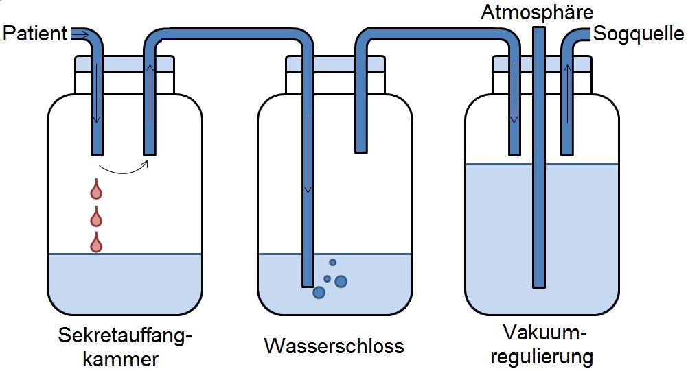Abbildung 5: Zweiflaschen-System. Durch eine zusätzliche Flasche, die der Regulierung des angelegten Sogs dient, ist das Dreiflaschen-System Grundbaustein moderner digitaler Systeme.