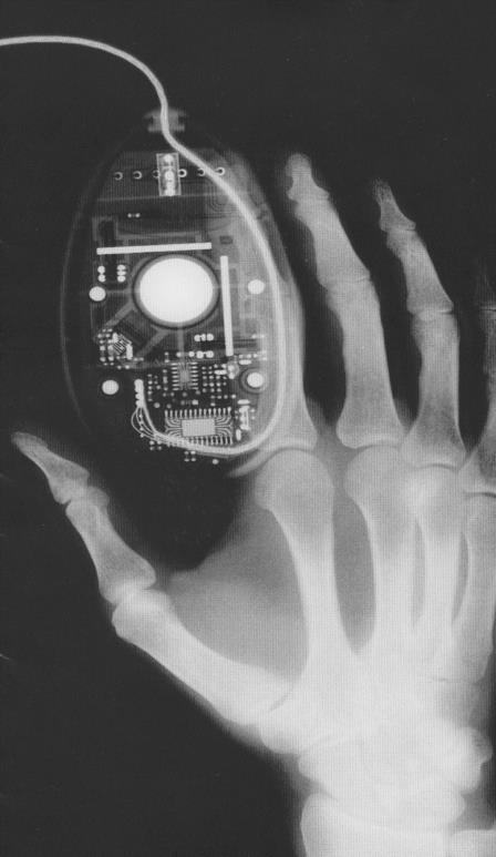Digitale Radiographie -DSA - Digitale Bildschirmradiographie - Digitale