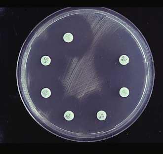 Resistenztestung von Staphylococcus aureus Häufigkeit von MRSA