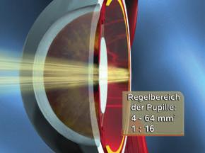 Der Film erläutert in ausführlichen 3D-Computeranimationen die Vorgänge im Auge, d.h. die unterschiedlichen Strahlengänge bei abgeflachter und kugeliger Linse.