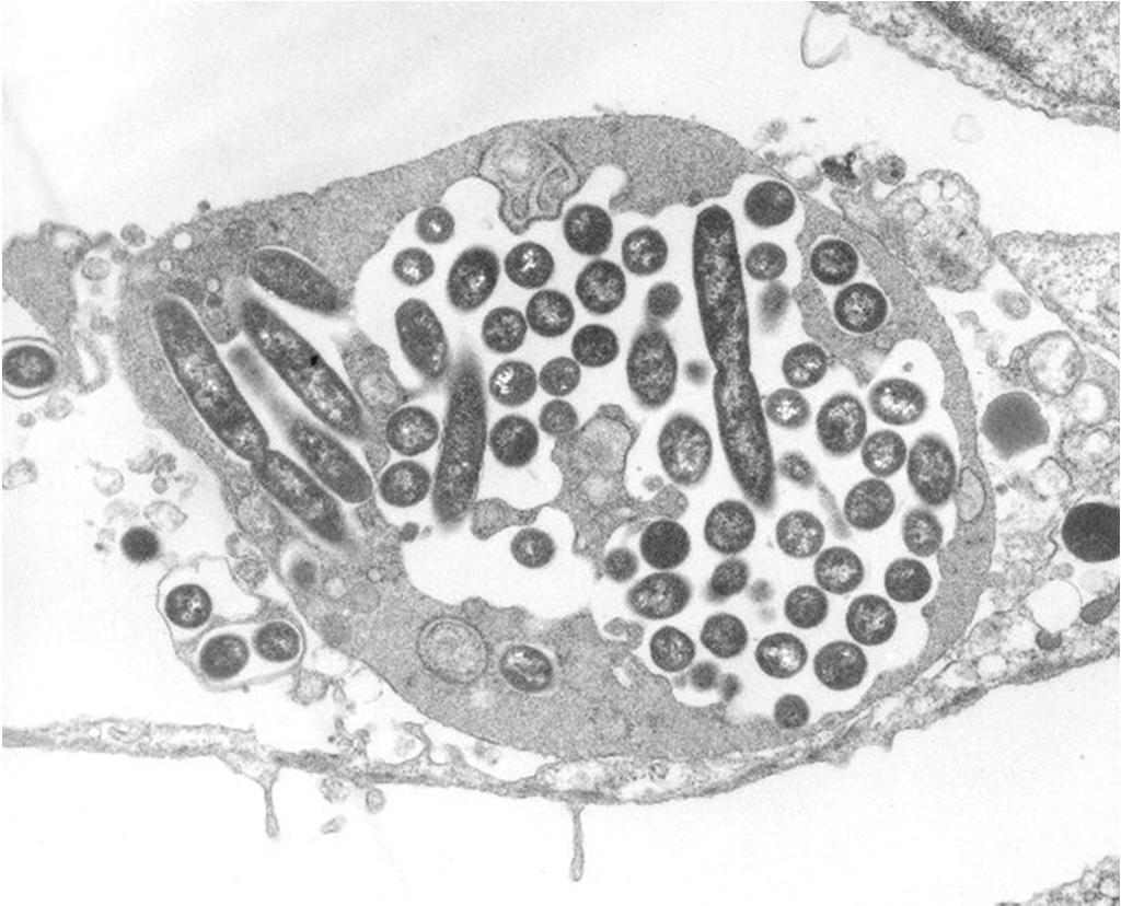Legionellen intrazellulär in einer Amöbe Legionellen