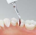 ein- und mehrwurzeligen Zähnen MODELL: G6 MODELL: G6-E REF: Z217106 EMS REF: