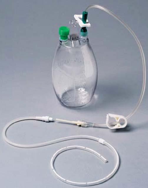 560 Abb. 1 PleurX -Katheter-System, das in unserer Klinik verwendet wird (Cardinal Health, Denver Biomedical, www.denverbio.com/physician_ pleurx_catheter.html).