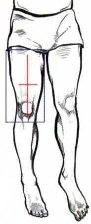 Zeichen: R oder L, lateral, a.p. Einblendung: auf Oberschenkel und Hautgrenze Lagerung mit Knie: a.p.: Der Patient liegt in bequemer Rückenlage auf dem Untersuchungstisch, Kopf unterpolstert, Arme am Körper entlang.