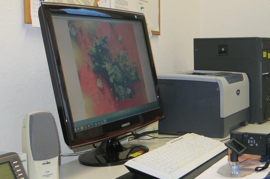 Die gesicherten Spuren können mittels mikroskopischer Auswertung mit einem Stereomikroskop mit digitaler HD-Kamera und labortechnischen Untersuchungen ausgewertet werden.