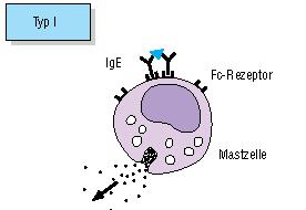 Allergie: 4 Immunreaktions-Typen Typ I: Sofortreaktion, spezifisches IgE