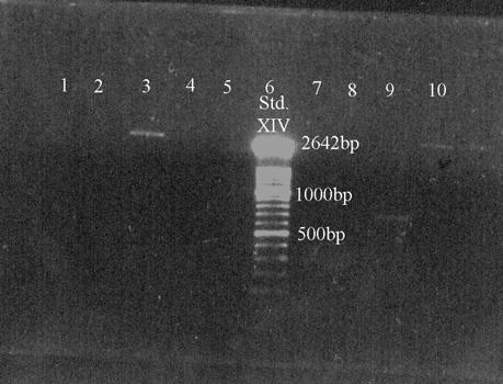 Banden von Spur 1 und 3 kommen durch den unterschiedlichen PCR-Primer zustande (siehe Versuchsteil 4.2.4.). Die beiden unteren Banden entsprechen dem geschnittenen Insert.
