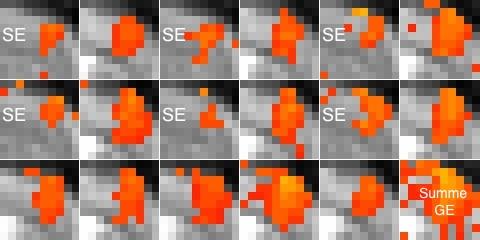 10. Einfluss der räumlichen Auflösung auf das BOLD-Signal bei 11.7 Tesla Abbildung 10.9.: Ausschnitt aus einer Untersuchung mit alternierenden S1FL- Aktivierungen mit SE-EPI- und GE-EPI-Sequenzen.