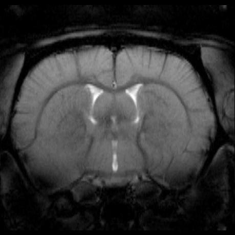 3. Magnetresonanztomographie Abbildung 3.10.: T 1 -undt2 -Kontrast der GE-Sequenz. In der T 1-gewichteten Aufnahme (links) sind die Umrisse von Gehirn, Muskeln und Haut klar dargestellt.
