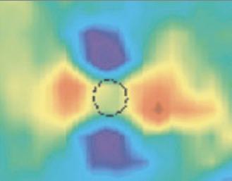 4. Funktionelle Magnetresonanztomographie lung in gelb-rot (positives Feld) und blau-lila (negatives Feld).