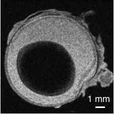 8. Einfluss der MRT- und Stimulationsparameter auf das BOLD-Signal Abbildung 8.1.: MRT-Aufnahme von einem Auge (FLASH, 62 62 250 µm 3, links) und dem Gehirn einer Ratte (FLASH, 62 62 1000 µm 3,mitte).