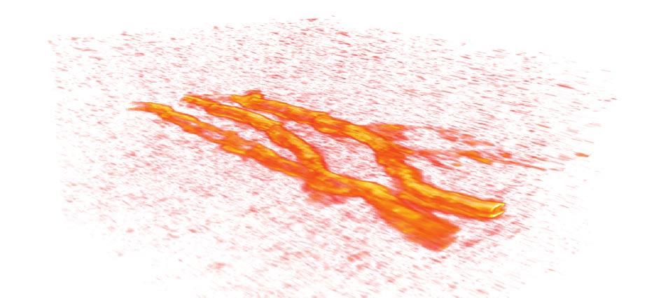 Arbeitsgruppe Biomedizinische Ultraschallforschung Abbildung 1: Dreidimensionale Rekonstruktion von Blutgefäßen im menschlichen Unterarm aufgenommen mittels optoakustischer Bildgebung.