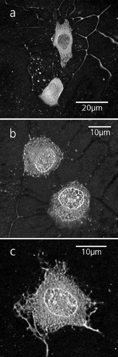 Abbildung 4: Nichtlineare Laser-Scanning-Mikroskopie von Strukturproteinen der Knochenhaut (Periost, Falschfarbendarstellung).