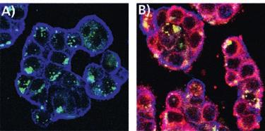 Abbildung 2: Zelluläre Aufnahme und intrazelluläre Verteilung von Nanopartikeln (A) und Nanopartikel-Wirkstoff-Konstrukten (B) in Tumorzellen.