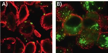 Abbildung 3: Zelluläre Aufnahme und intrazelluläre Verteilung von unmodifizierten (A) und spezifischen Ligand-modifizierten Nanopartikeln (B) in Tumorzellen.