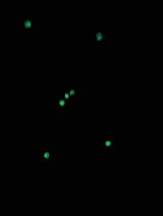 Wir wählten einen Maßstab, wo 1cm in echt 3 Lichtjahren entspricht und wir somit nur alle Angaben mit 3 multiplizieren mussten.