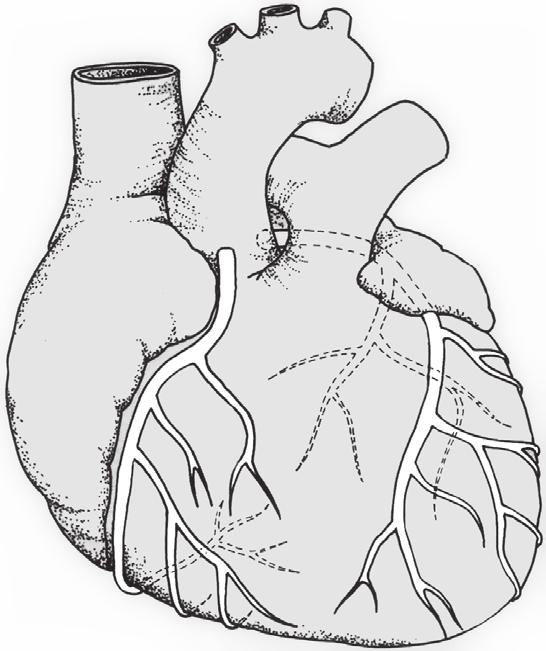 11 1 Blutkreislauf Hauptschlagader Lungenschlagader Linker Hauptstamm Umschlingender Ast Rechte Herzkranzarterie Vorderer absteigender Ast.