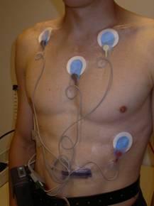 - EKG (lange Streifen): häufig nicht ausreichend informativ - Holter-EKG: 24 oder neulich manchmal 48 Stunden lang - Ereignis-Holter: speichert das EKG bei