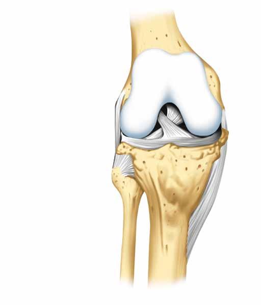 Das Kniegelenk Das Kniegelenk verbindet Oberschenkelknochen und Schien- Oberschenkelknochen (Femur) bein.