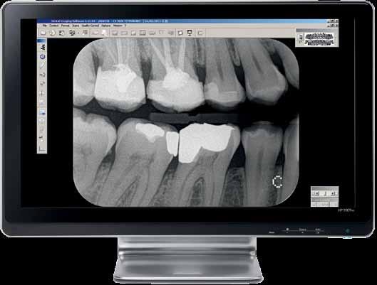 Intuitive Software, einfache Weitergabe von Bildern Unsere Dental Imaging Software dient, ob als eigenständiges oder in Ihre