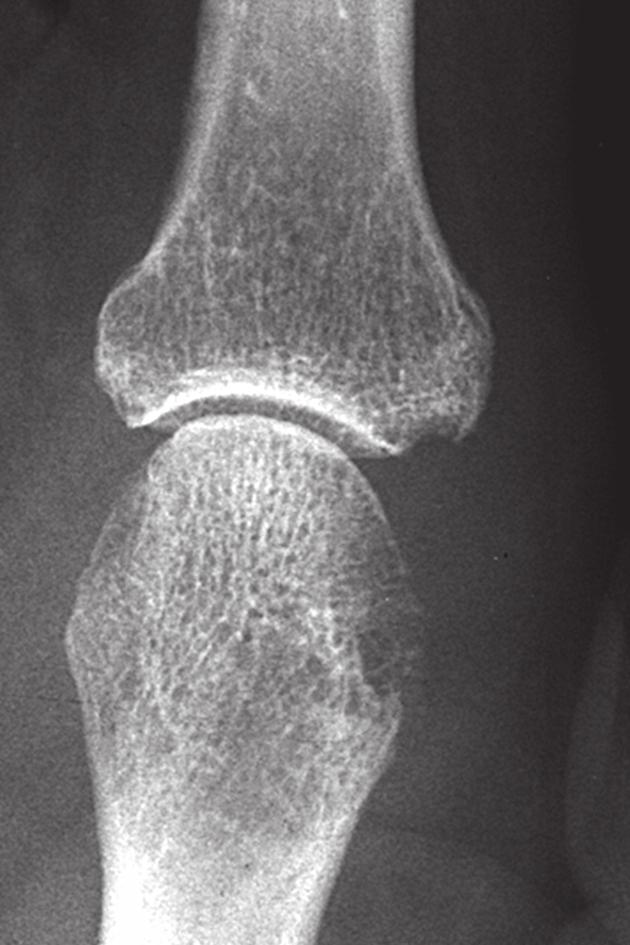 11 S. Wassenberg: Konventionelles Röntgen in der Rheumatologie überholt oder weiter unverzichtbar?