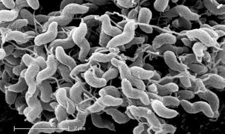 Elektronenmikroskopische Aufnahme von Campylobacter sp. VORKOMMEN Infektionen durch Campylobacter sind weltweit verbreitet und treten gehäuft in der warmen Jahreszeit auf.
