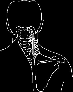 Kapitel 4: Schmerzen in Kopf-, Hals- und Nackenmuskeln 93