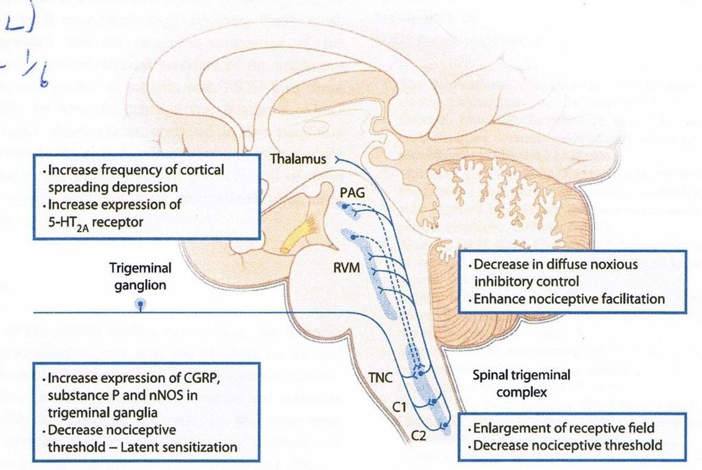 Pathophysiological concepts Orbitofrontal Cortex +/- Kopfschmerzen Pr