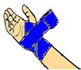 Legen eines Handgelenkverbandes 1 Wickle die Binde 2 Mal ums Handgelenk zur Hohlhand.