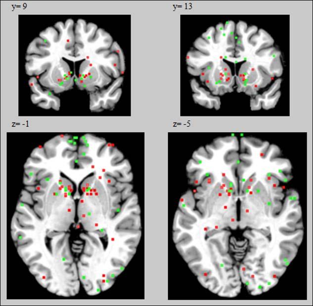 2. Material und Methoden Gehirnkarten auf einem MNI-Standardgehirn (Colin27_T1_seg_MNI.nii) visualisiert (Laird et al. 2005).