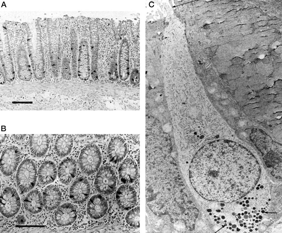 Inkretine GLP-1 sezernierende L-Zellen im Ileum- und Kolonepithel