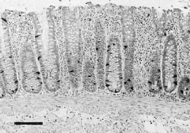 GLP-1 und Behandlung des T2DM Inkretine Gila Monster (Heloderma suspectum) Dünndarm DPP IV resistente