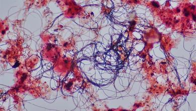 Der Feind im Abwasser- Fadenbakterien in kommunalen Kläranlagen Fadenbakterien stören Sedimentation Microthrix parvicella, Nostocoida limicola - Wachstumsvorteile ggü.
