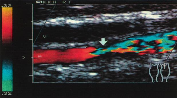 Diagnostik Folgendes diagnostisches Leistungsspektrum bieten wir Ihnen in der Angiologie und der Inneren Medizin.