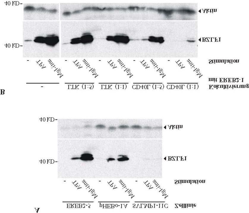 Ergebnisse 48 Abbildung 8: LMP1 und aktiviertes CD40 hemmen die durch TPA und anti-igm induzierte BZLF1- Expression.