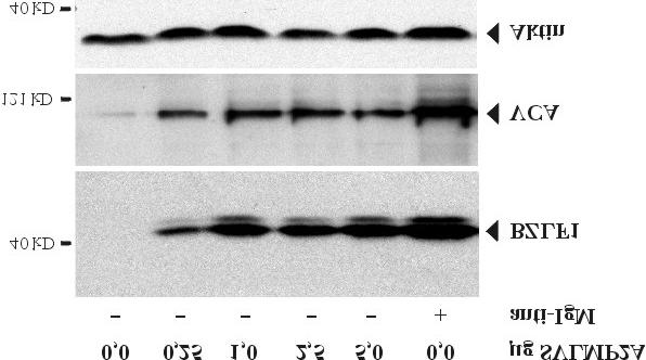 Ergebnisse 86 B: Einige der isolierten Zellen wurden auf einem Objektträger fixiert, mit einem anti-lmp2a-antikörper (unverdünnt) und einem sekundären, Cy3-markierten Antikörper für
