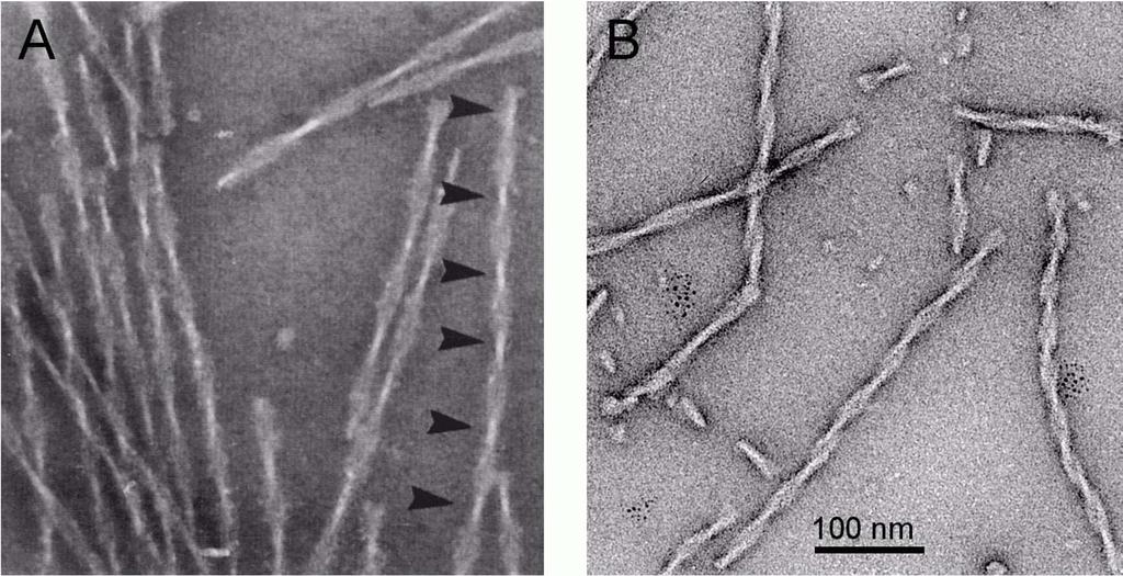 Mikrotubuli-bindende Proteine
